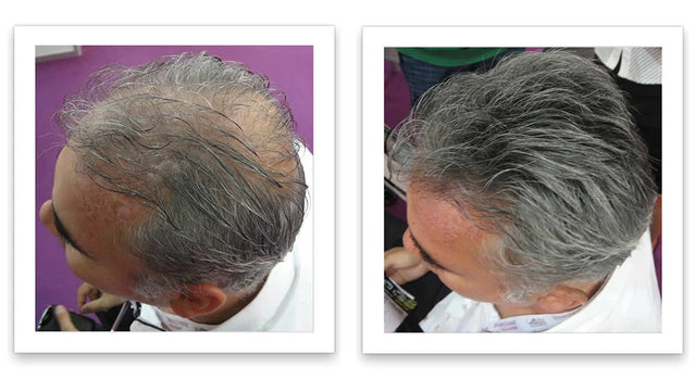 Antes y después del uso de Caboki 30 g — foto de resultado del propio cliente