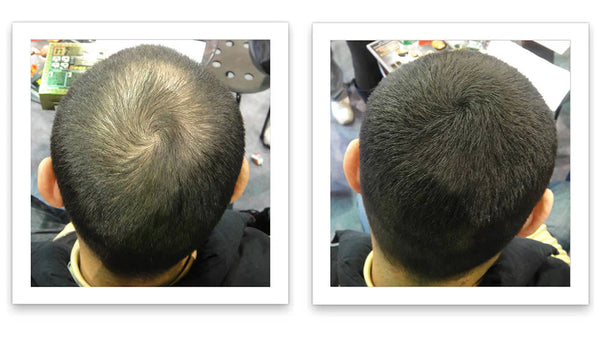 Antes y despues del uso de Caboki 30 g — foto de resultado del propio cliente