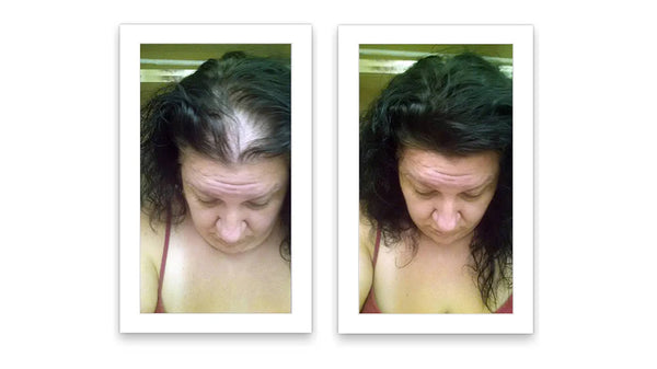 Antes y despues del uso de Caboki 30 g — foto de resultado del propio cliente