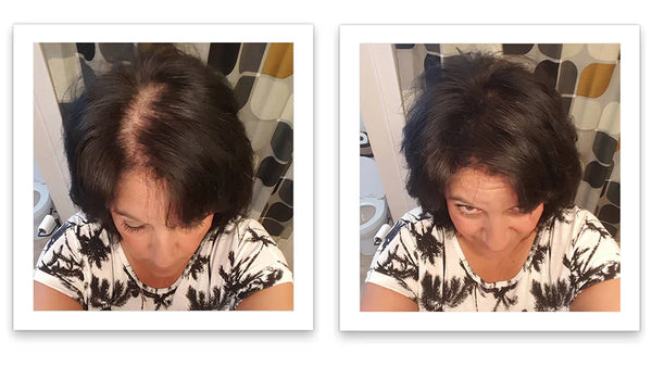 Antes y despues del uso de Caboki 30 g — foto de resultado del propio cliente
